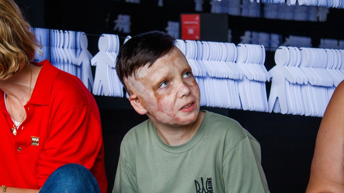 Tlumočnice se rozplakala, když ukrajinský chlapec líčil ruský útok ve Vinnycji